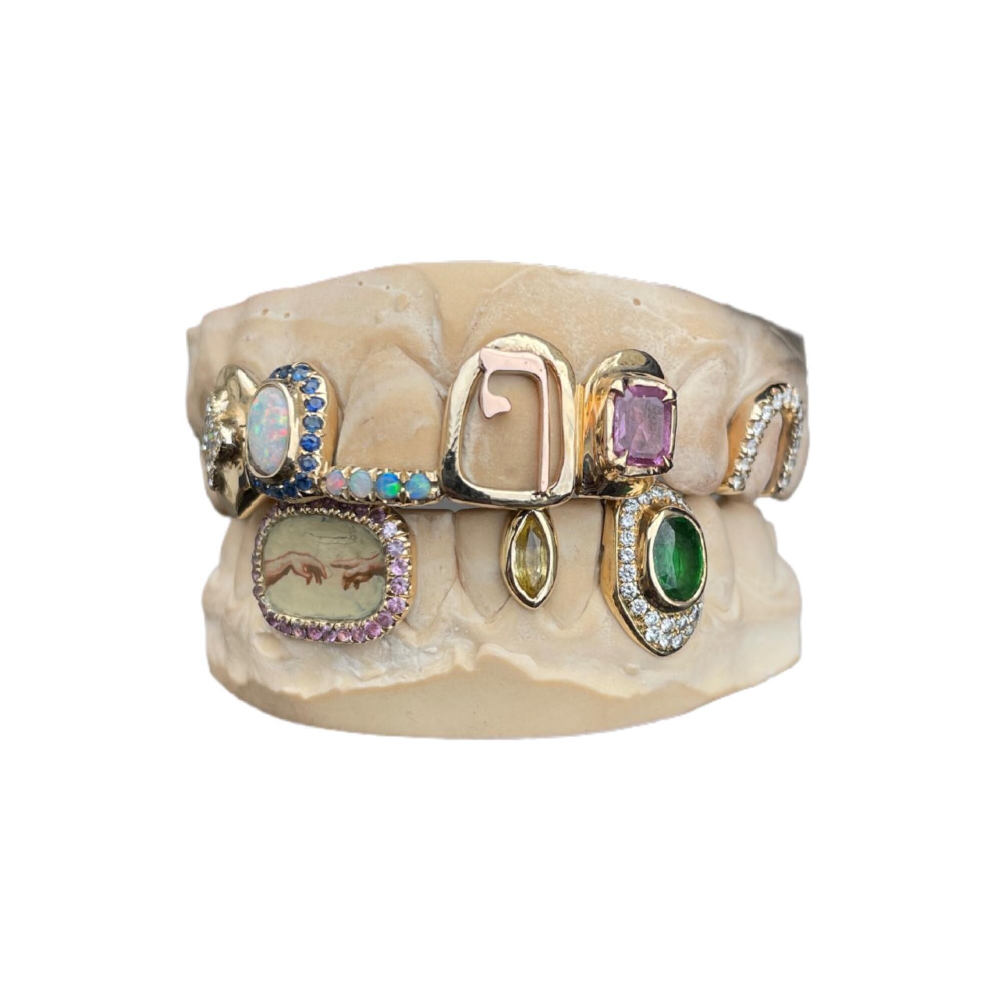 Photo of teeth jewelry from Youth Grillz Paris.